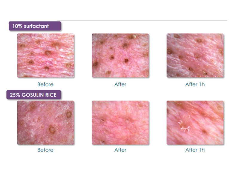 Gosulin Rice – An ingredient that can instantly remove blackheads
